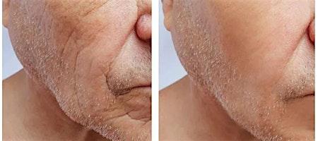 collagen-biostimulator-injection-training-brooklyn-ny-event image